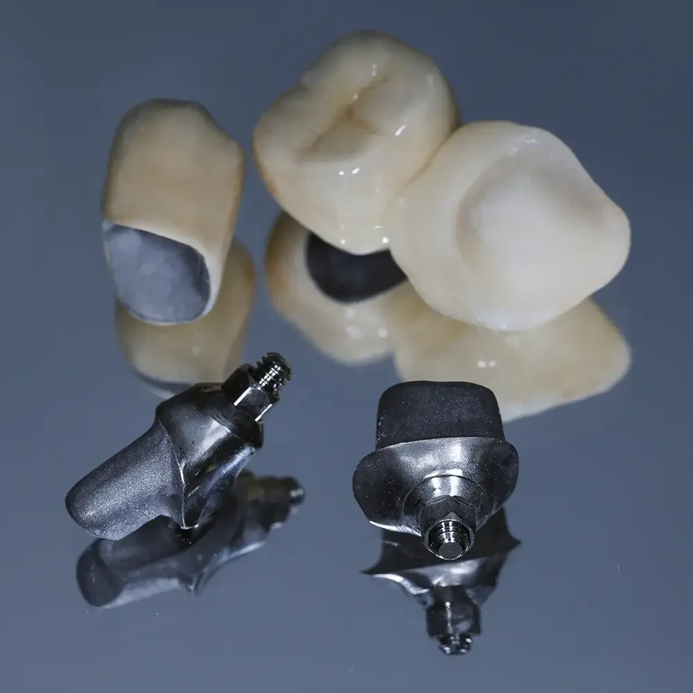 corona dental metal-ceramica