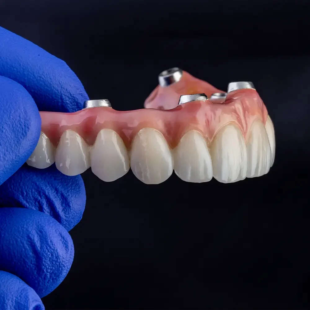 protesis dental bilbao