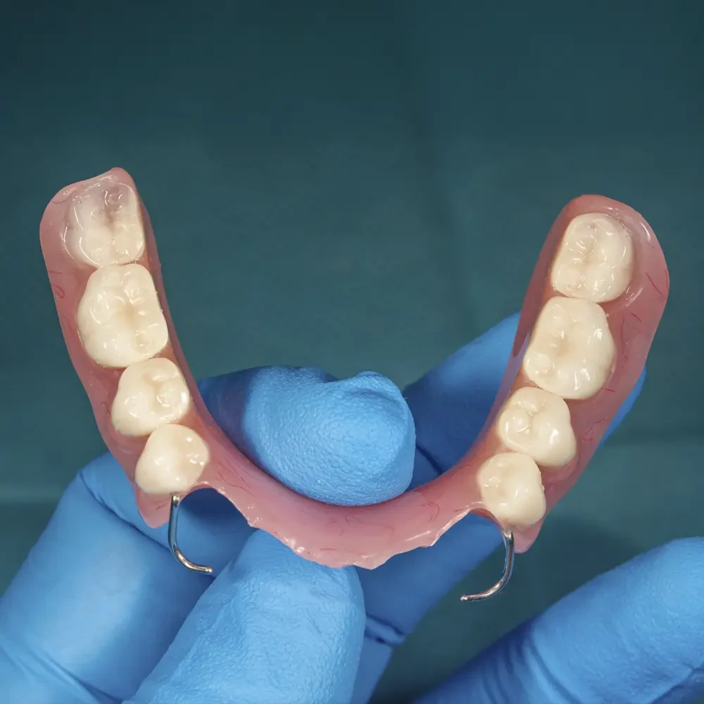 prótesis dental removible