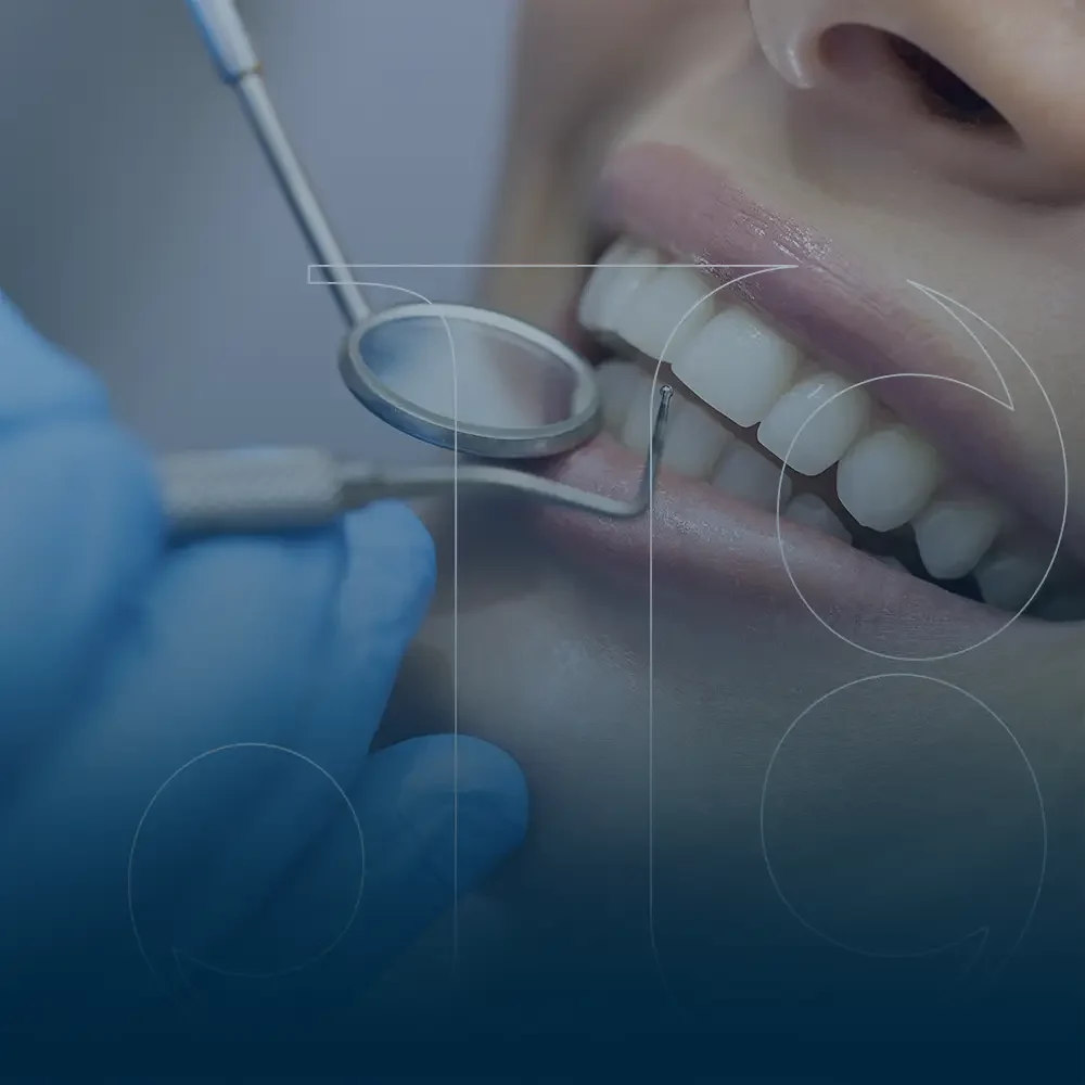 reconstrucción dental